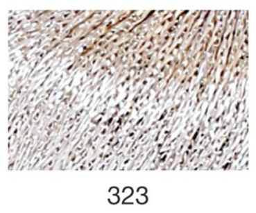 NORA metallisiertes Häkelgarn / Strickgarn 25 gr. Farbe 323