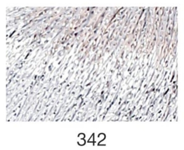 NORA metallisiertes Häkelgarn / Strickgarn 25 gr. Farbe 342